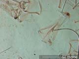 Tyrophagus Mite