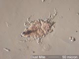 Mite