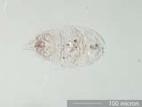 Mite Larva