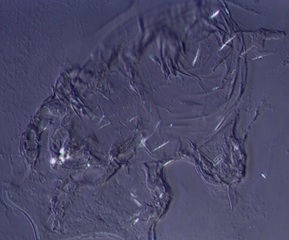 Indoor Mite