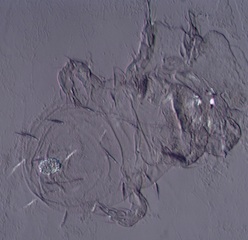Indoor Mite