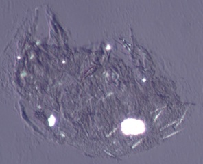 Indoor Mite