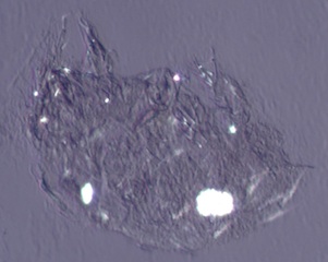 Indoor Mite
