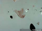 Mite Fragment