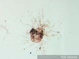 Mite