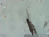 Mite Fragment