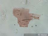 Mite Fragment