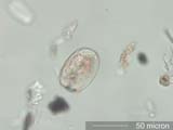Mite Egg