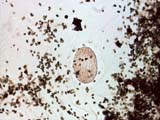 Mite Egg