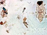 Mite Fragment