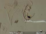 Mite Leg