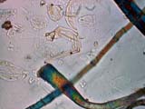 Mite Leg