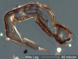 Mite Leg
