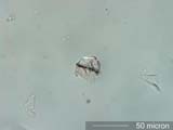 Mite Fragment