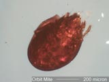 Oribata Mite