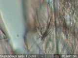 Mite Setae Under the Microscope