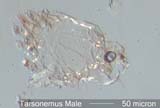 Mite Leg