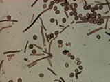 Chaetomium