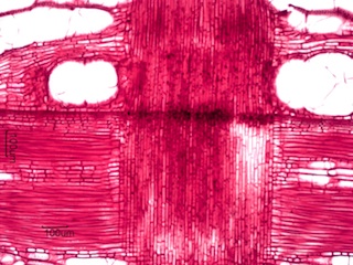 Morus rubra, Radial-Section
