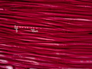 Morus rubra, Radial-Section