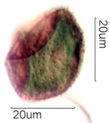 Moss Spore