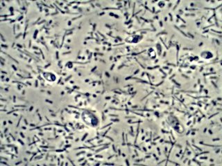 Brragg's Cider Vinegar Mother Under the Microscope