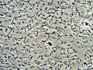 Brragg's Cider Vinegar Mother Under the Microscope
