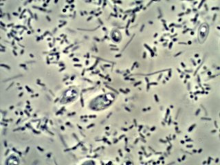 Cider Vinegar Mother Under the Microscope