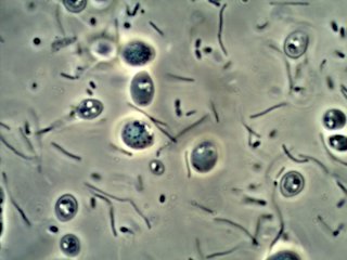 Corn Vinegar Mother Under the Microscope