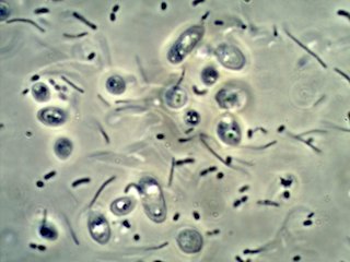 Corn Vinegar Mother Under the Microscope