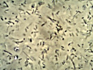 Malt Vinegar Mother Under the Microscope