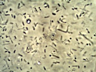 Malt Vinegar Mother Under the Microscope