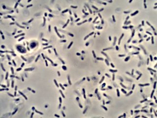 Red Wine Vinegar Mother Under the Microscope