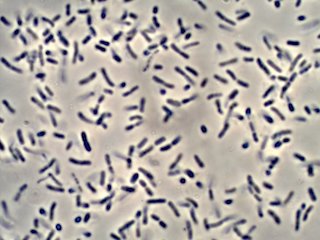 Red Wine Vinegar Mother Under the Microscope