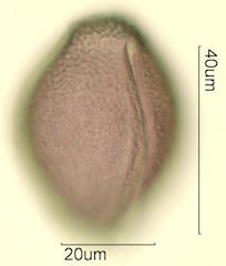 Mojave Mound Cactus (Echinocereus triglochidiatus) Pollen