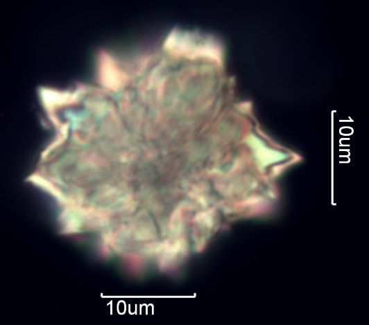 Calcium Oxalate Phytoliths