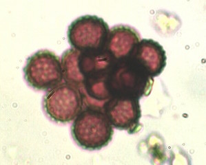 Myxomycetes Spores