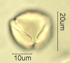 Cat's Claw Honey Pollen Under the Microscope
