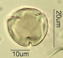 Cat's Claw Honey Pollen Under the Microscope