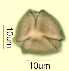 Cat's Claw Honey Pollen Under the Microscope