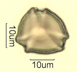Cat's Claw Honey Pollen Under the Microscope