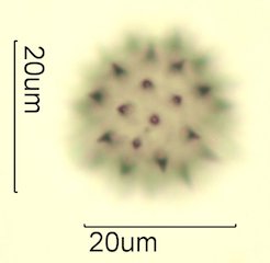 Cat's Claw Honey Pollen Under the Microscope