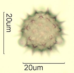 Cat's Claw Honey Pollen Under the Microscope