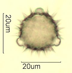 Cat's Claw Honey Pollen Under the Microscope