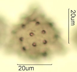 Cat's Claw Honey Pollen Under the Microscope