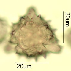 Cat's Claw Honey Pollen Under the Microscope
