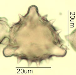 Cat's Claw Honey Pollen Under the Microscope