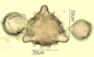 Cat's Claw Honey Pollen Under the Microscope