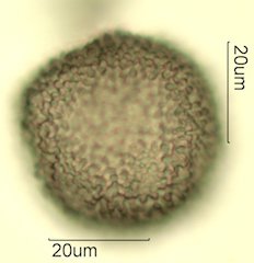 Cat's Claw Honey Pollen Under the Microscope