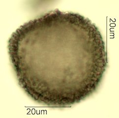 Cat's Claw Honey Pollen Under the Microscope